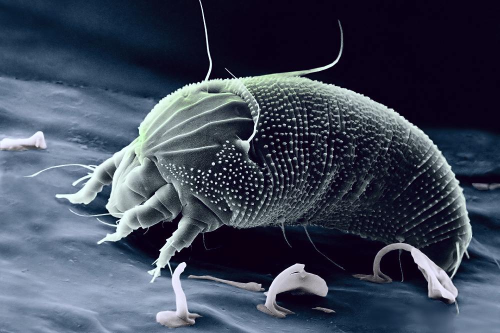 Struggling with dust mites in your fabric bed? Learn how to prevent them with these simple cleaning and maintenance tips for a healthier, allergen-free sleep.